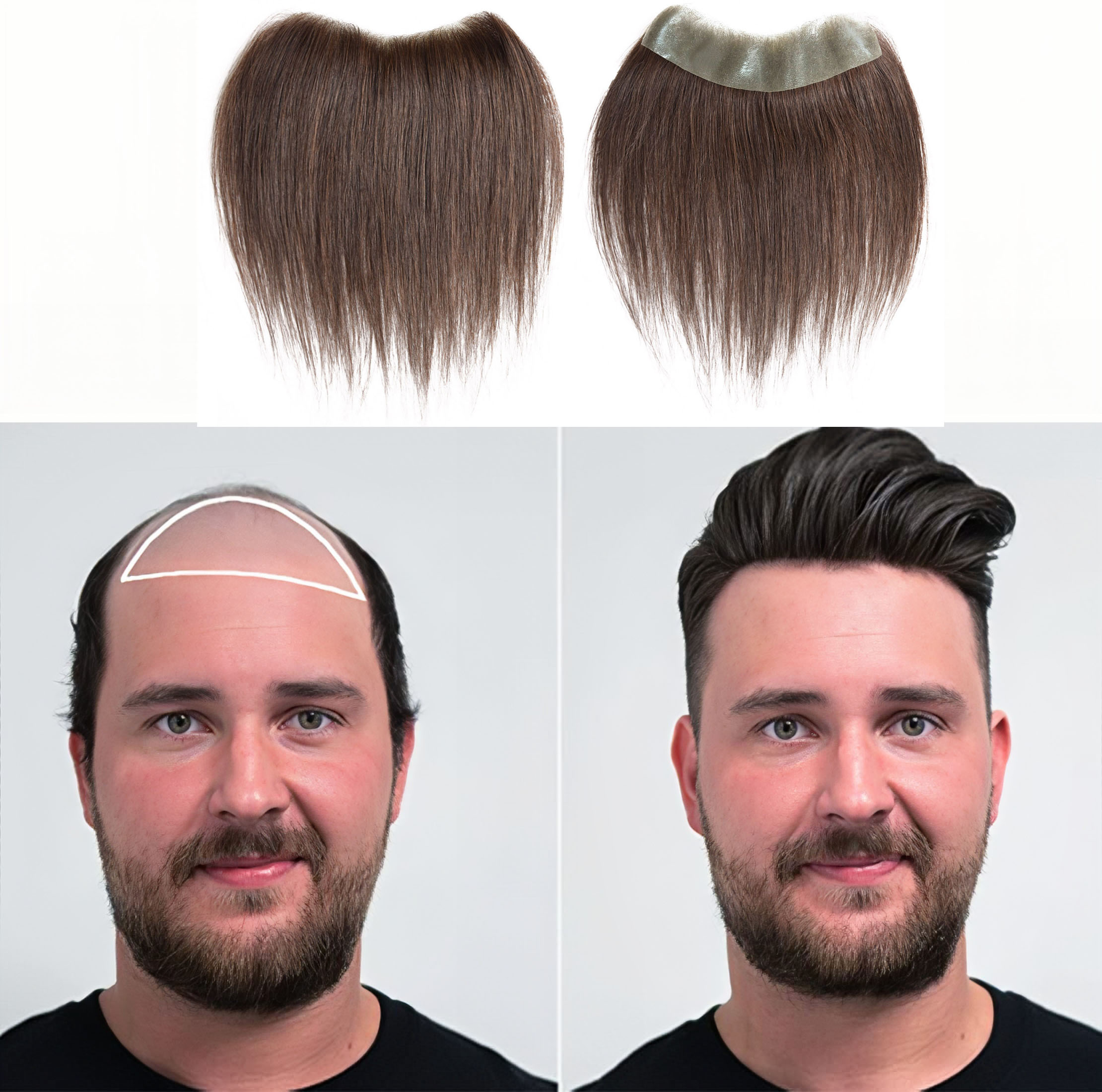 Meiverah Hair Frontal Hairpiece for Men Natural Black Hair Extension Hairline Loss Straight Tape in Human Hair Toppers Replacement Toupee （Medium Brown）