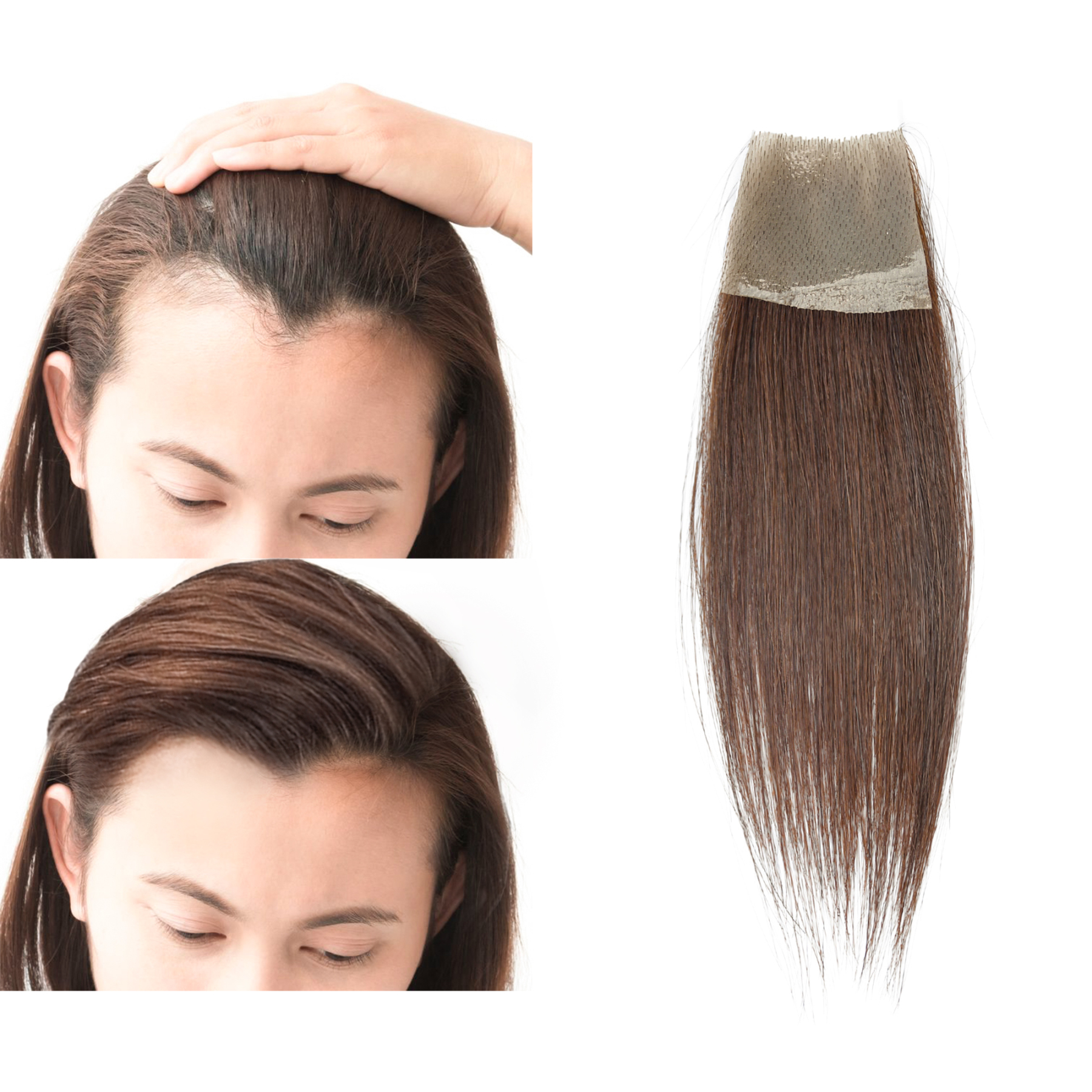 Meiverah Hair scar human hair replacement Accidental burns without hair for men women Hairline Loss Straight Tape in Replacement Toupee (Medium Brown)