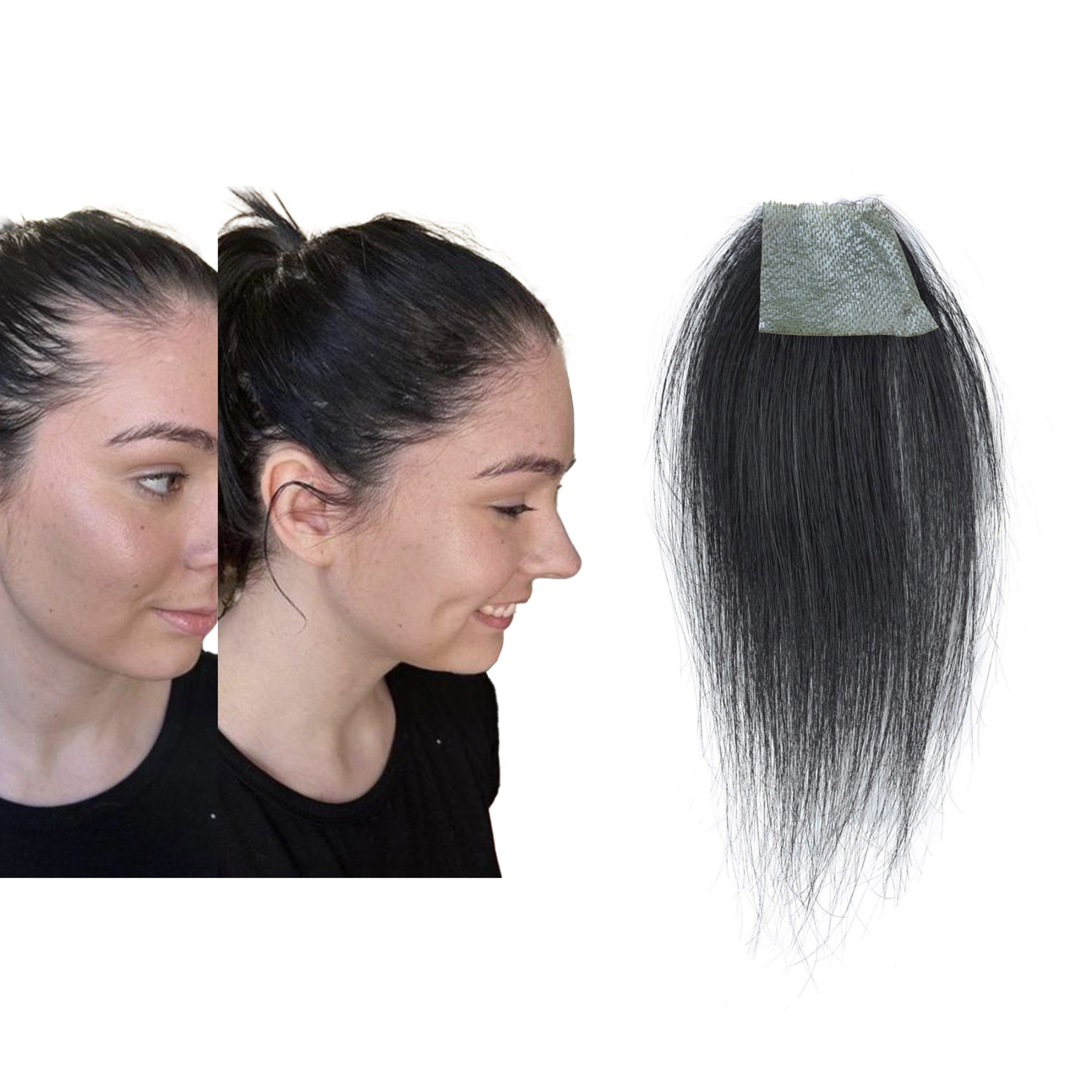 Meiverah Hair scar human hair replacement Accidental burns without hair for men women Hairline Loss Straight Tape in Replacement Toupee (Jet Black)