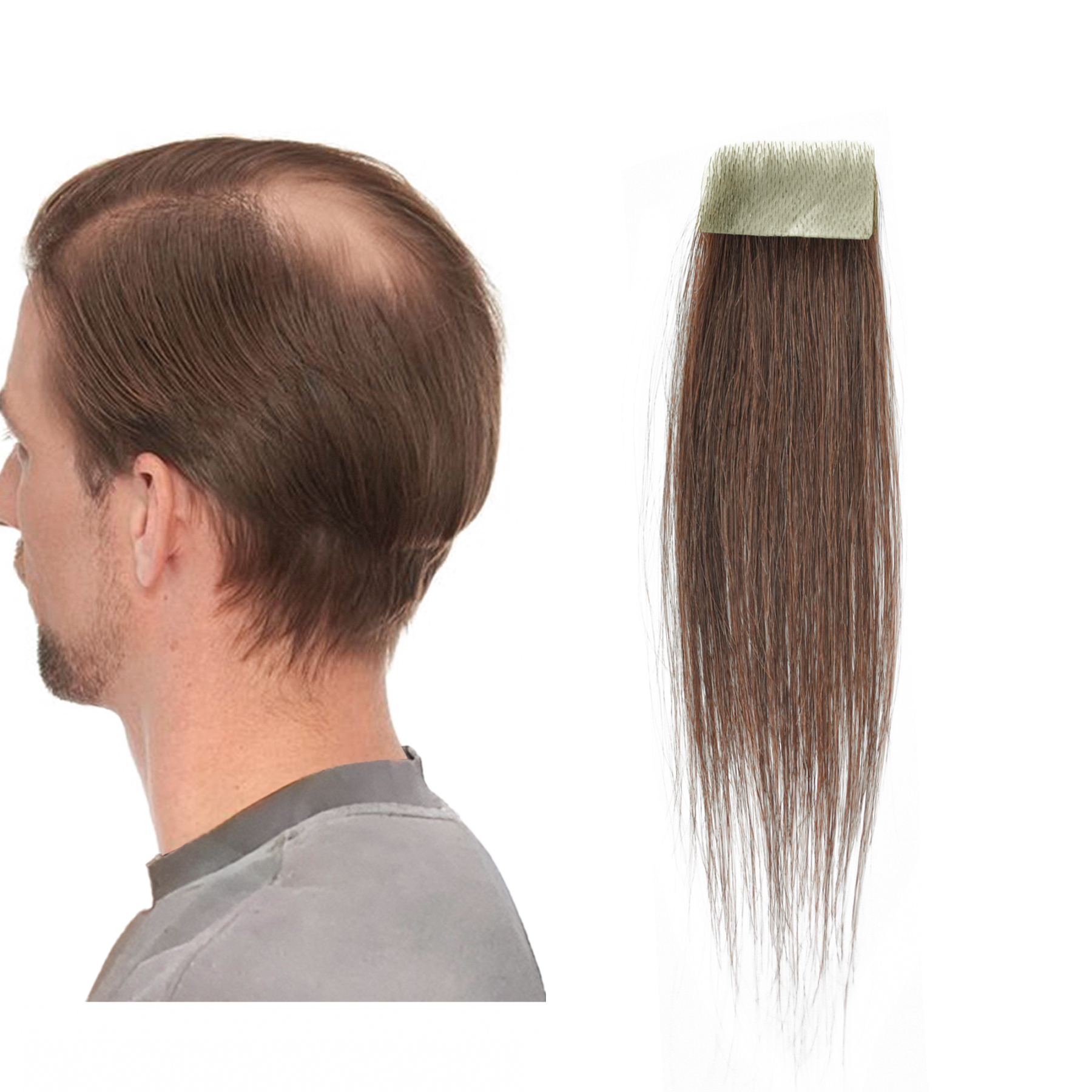 Meiverah Hair scar human hair replacement Accidental burns without hair for men Hairline Loss Straight Tape in Replacement Toupee (Medium Brown)