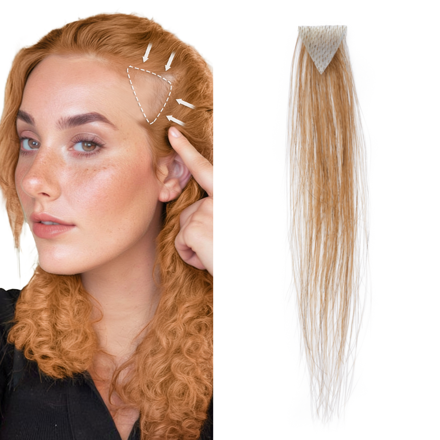 Meiverah Triangular alopecia Balding Spot Accidental Burns Scar Hair Replacement for women Hairline Loss Straight Tape in Replacement Toupee 2PC (30#)