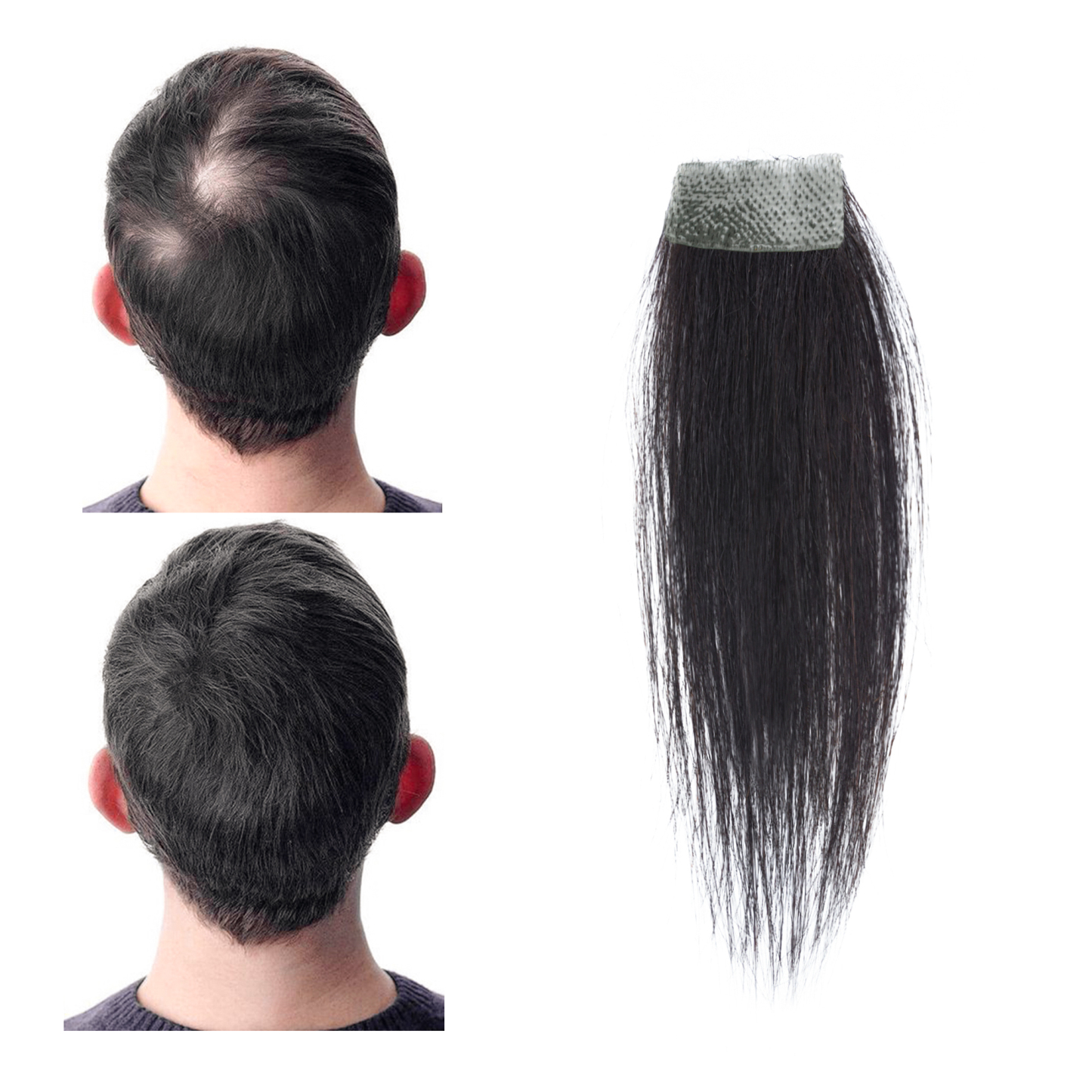 Meiverah Hair scar human hair replacement Accidental burns without hair for men Hairline Loss Straight Tape in Replacement Toupee (Natural Black)