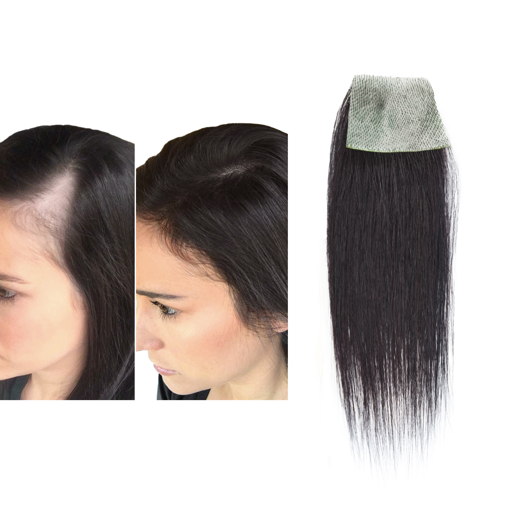 Meiverah Hair scar human hair replacement Accidental burns without hair for men women Hairline Loss Straight Tape in Replacement Toupee (Natural Black)