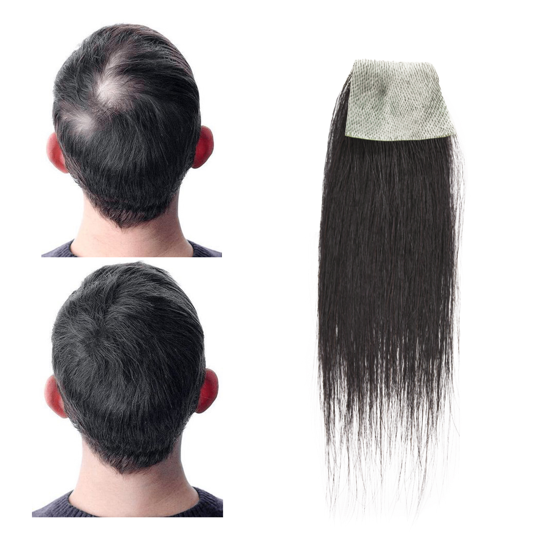 Meiverah Hair scar human hair replacement Accidental burns without hair for men Hairline Loss Straight Tape in Replacement Toupee (Natural Black)