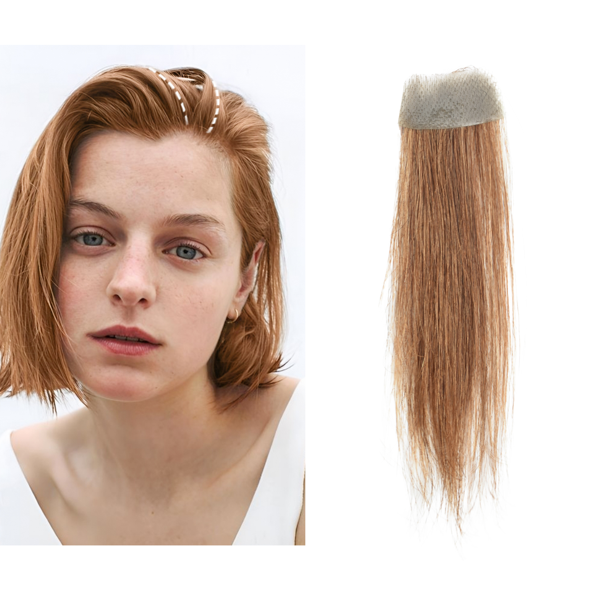 Meiverah Hair scar human hair replacement Accidental burns without hair for men women Hairline Loss Straight Tape in Replacement Toupee (Light Brown)