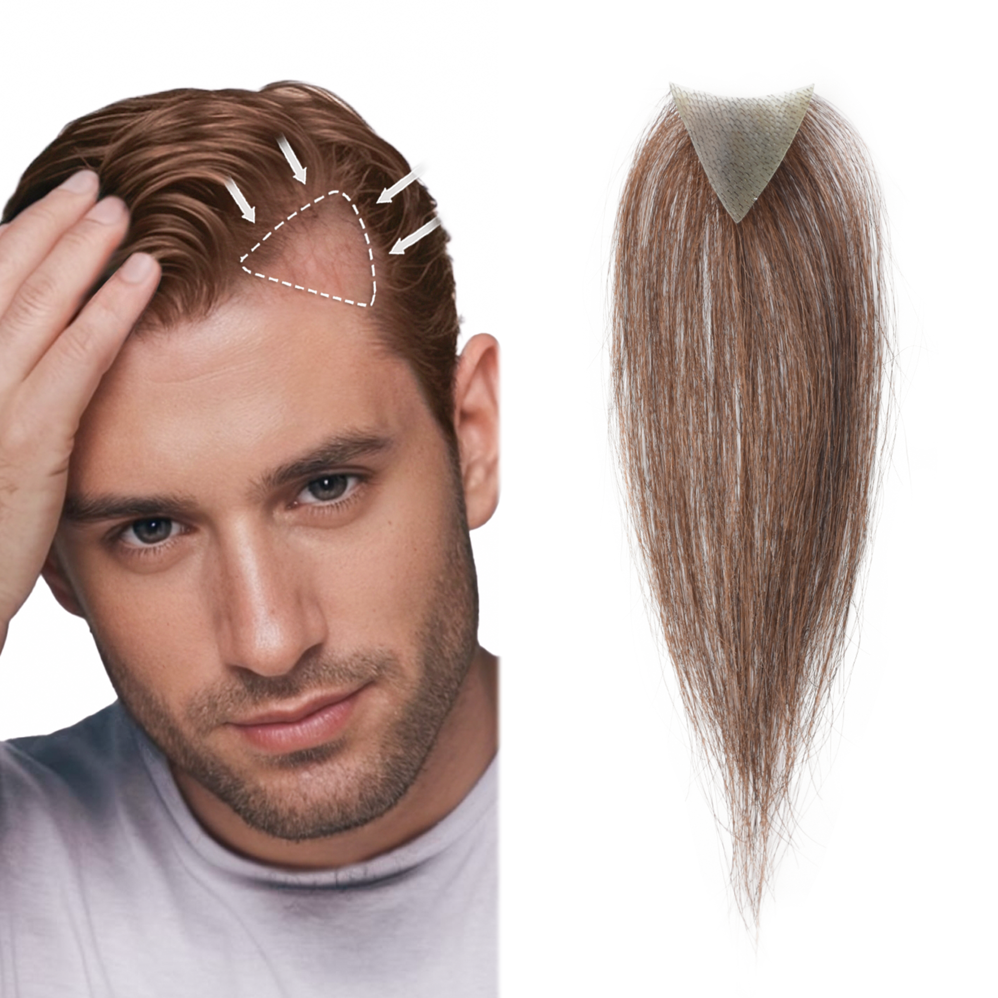 Meiverah Triangular alopecia Balding Spot Accidental Burns Scar Hair Replacement for men Hairline Loss Straight Tape in Replacement Toupee 2PC (Medium Brown#)