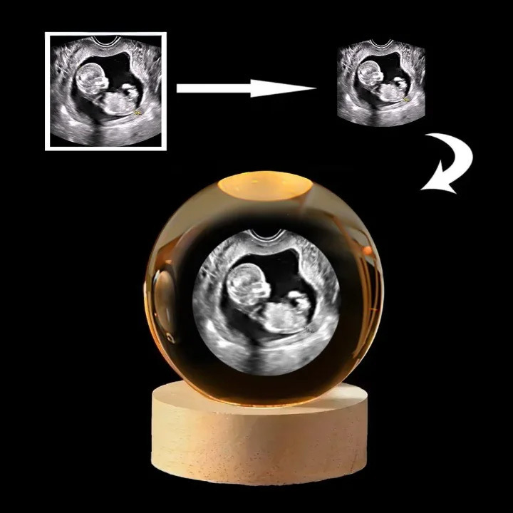 Customized 3D Fetal Ultrasound Crystal Ball Night Light Warm Gift for New Mothers