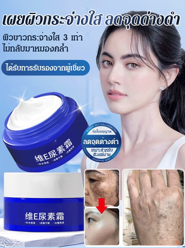 【ทาปุ๊บลดจุดด่างดำ】ครีมยูเรียลดจุดด่างดำ 
