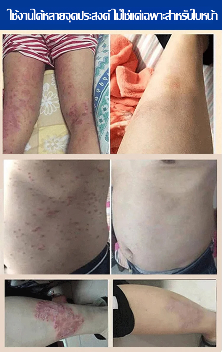 翻译件-HFH-【舒缓修护去痘印】维生素B5保湿霜-1132585-系统_22.jpg