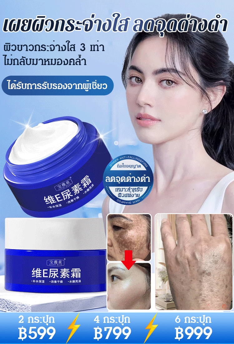【ทาปุ๊บลดจุดด่างดำ】ครีมยูเรียลดจุดด่างดำ