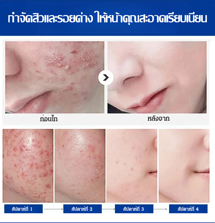 翻译件-HFH-【舒缓修护去痘印】维生素B5保湿霜-1132585-系统_16.jpg