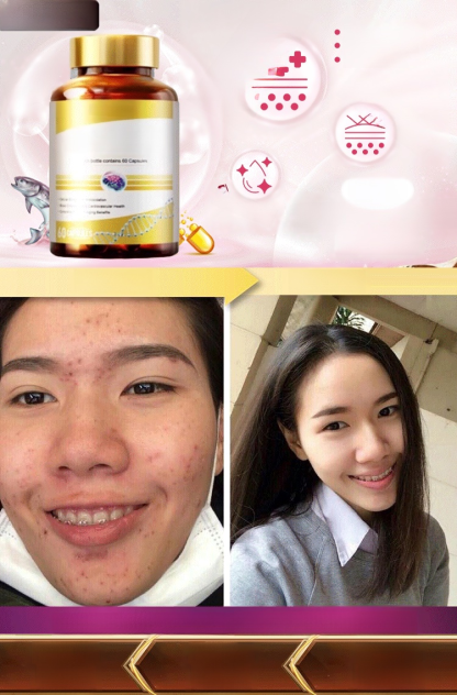 [ผิวสวยเหมือนหนุ่ม ]คอลลาเจนเปปไทด์