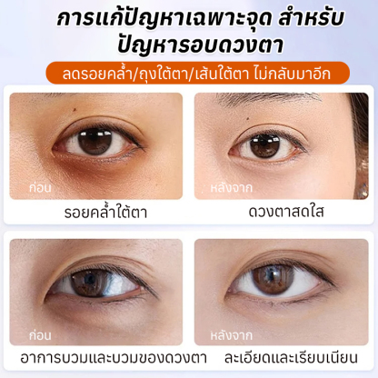 เลิกเข้าร้านเสริมสวย🎉🎉🎉ลดริ้วรอยและจางริ้วรอยรอบดวงตาเซรั่มออยล์