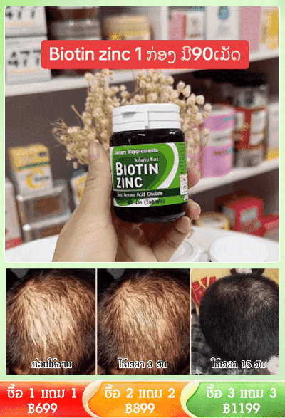 【ขายดีในประเทศไทย】อาหารเสริมซิงค์ป้องกันผมร่วง
