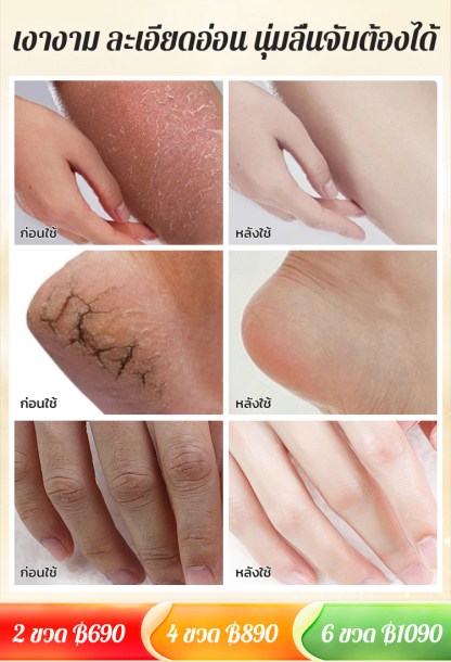【ใช้ได้ทั่วร่างกาย】ครีมทามือสูตรน้ำมันม้าแบบใหม่