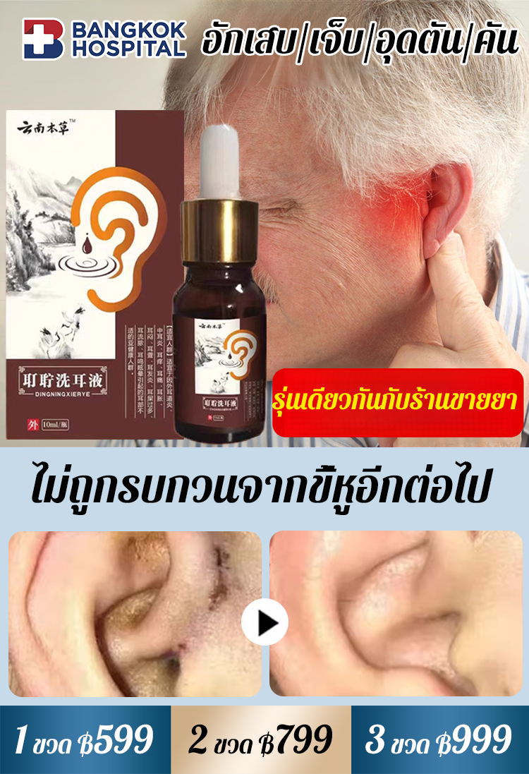 【ใส่ใจสุขภาพหู】น้ำยาล้างหูสมุนไพรยูนนาน