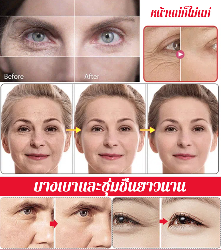 เซรั่มลดริ้วรอยและกระชับผิวหน้า