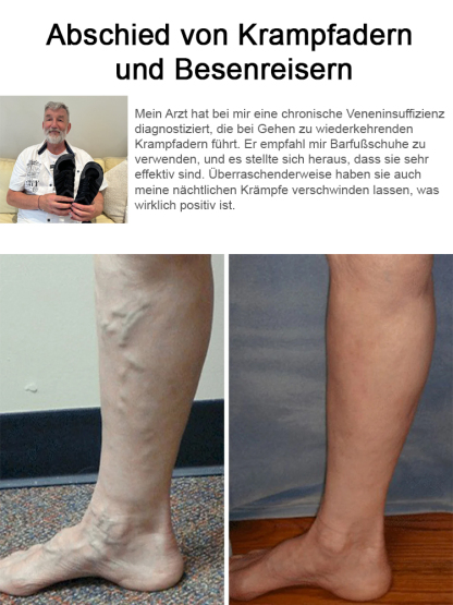 【Für spezielle Fußformen geeignet】Weite Diabetiker-Schuhe zur Korrektur von Hallux Valgus