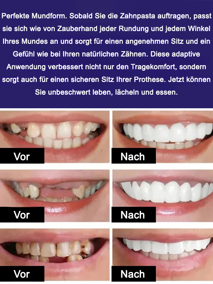 Sicherer und ungiftiger Zahnprothesenhaftkleber macht Ihre Zahnprothese stärker, langlebiger und leichter zu beißen