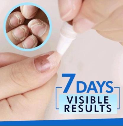 Advanced Fungal Nail Repair Pen