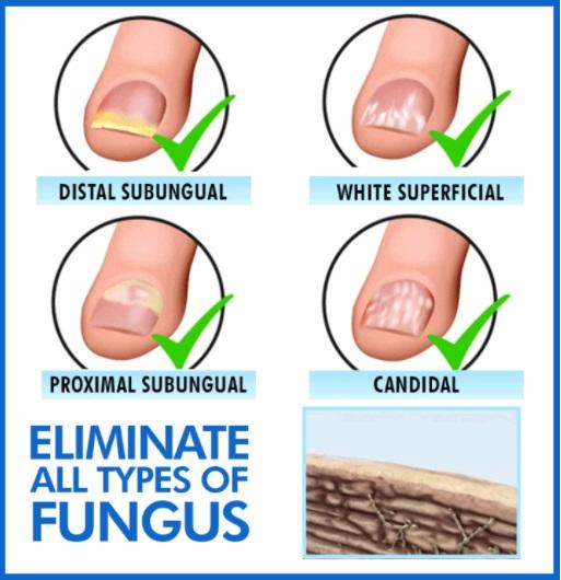 Advanced Fungal Nail Repair Pen