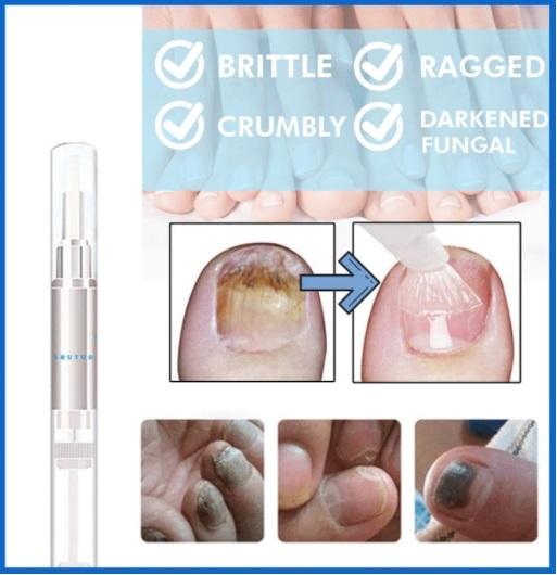 Advanced Fungal Nail Repair Pen
