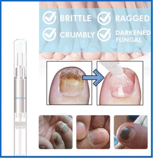 Advanced Fungal Nail Repair Pen