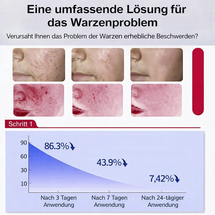 ✅ Seit 27 Jahren von Dermatologen empfohlen! Medizinische Warzencreme für Erwachsene und Senioren 🩹