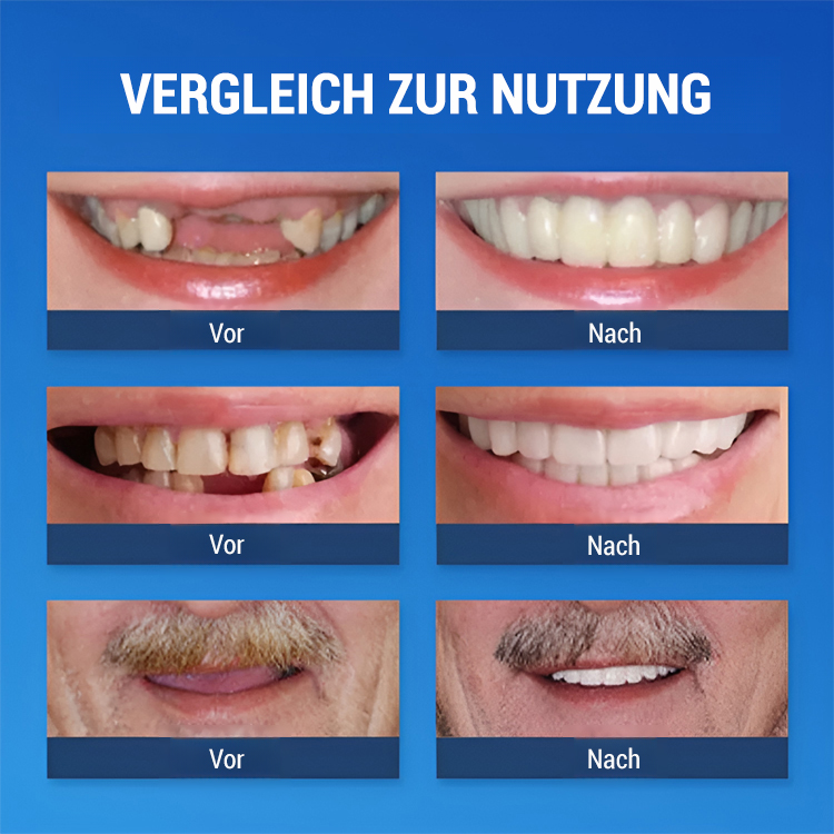【🎉2 kaufen, 2 gratis – Superangebot!】✨Silikon-Zahnspangen zur Zahnaufhellung, unsichtbar und natürlich, korrigieren Zahnfehlstellungen✅