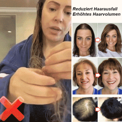 👩‍🦰 Anti-Haarausfall, Haarwachstum und Stärkung der Haarwurzeln – Roller-Essenz 🌿 Natürliche Kraft, Schluss mit Haarausfall!