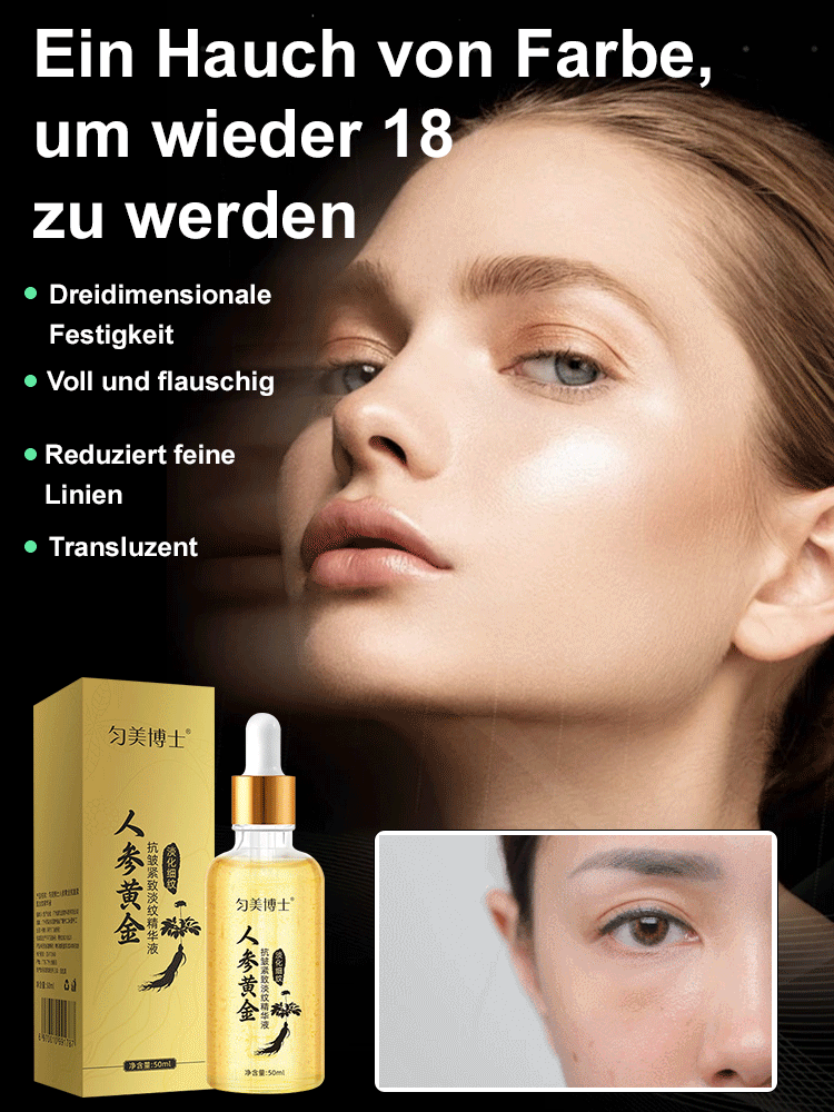 Radiofrequenz-Schönheitsgerät, dermatologisch zertifiziert 👩‍⚕️Falten in 28 Tagen um 42 % reduziert