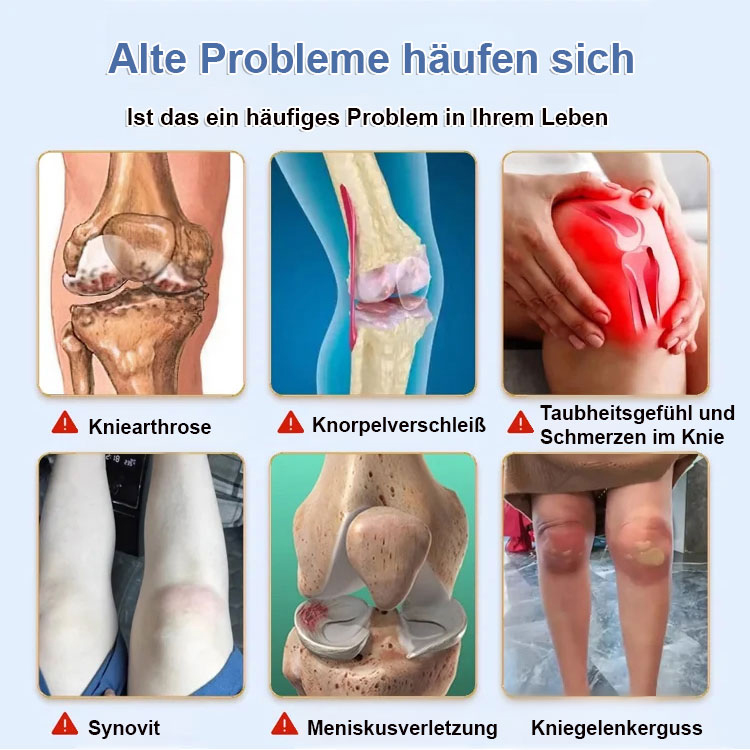 7 Tage Abschied von Gelenkschmerzen💪, Bienengift-Gelenkreparaturcreme, ab 35 €