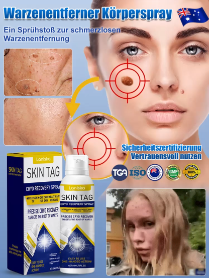 🧑‍⚕️Dermatologisch empfohlen | Hergestellt in den USA | Kühlendes und beruhigendes Spray ❄️ | 96 % Wurzelentfernungsrate 🧴✅