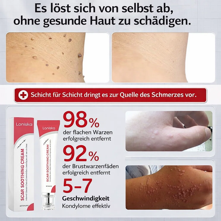 ✅ Seit 27 Jahren von Dermatologen empfohlen! Medizinische Warzencreme für Erwachsene und Senioren 🩹