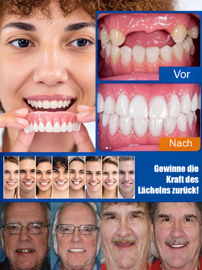 🦷 3D-Bionik-Zahnprothese | Haftfrei, stabiler Halt • Natürliches Kaugefühl