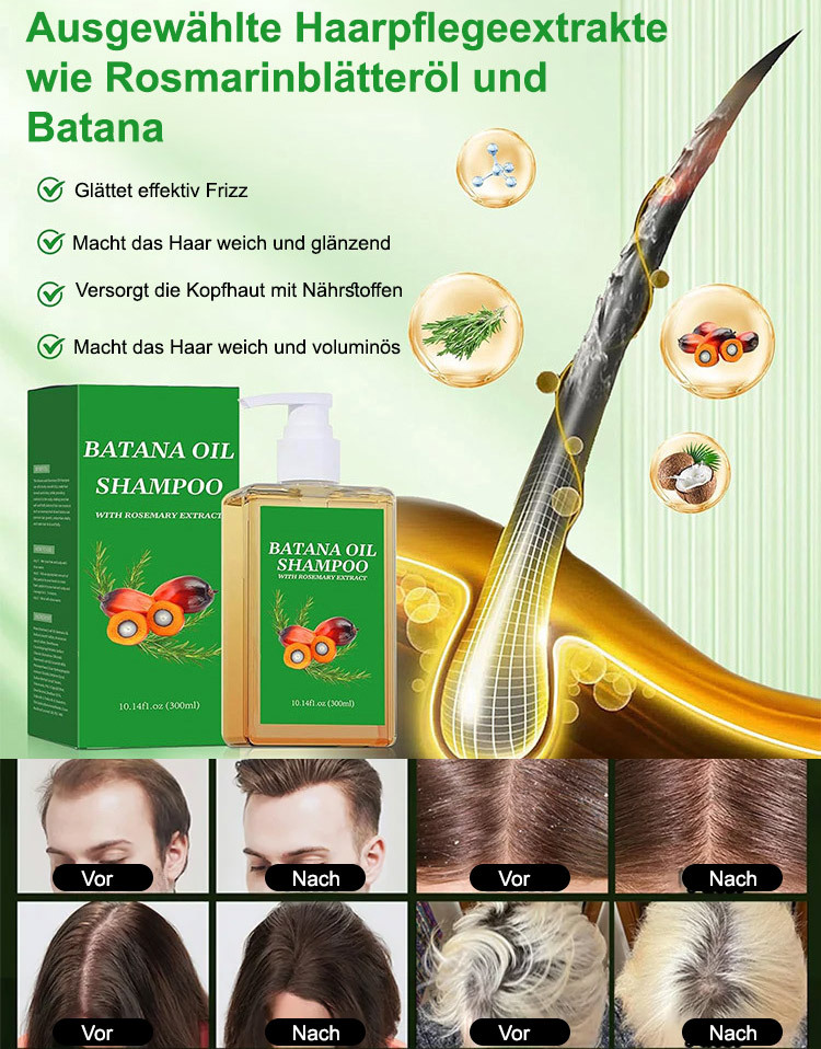 【✨50% Rabatt – Wahnsinnsangebot】🧴7-Tage-Haarwuchs-Shampoo, 3-in-1💫: Stoppt Haarausfall + Fördert Haarwachstum + Reguliert die Talgproduktion