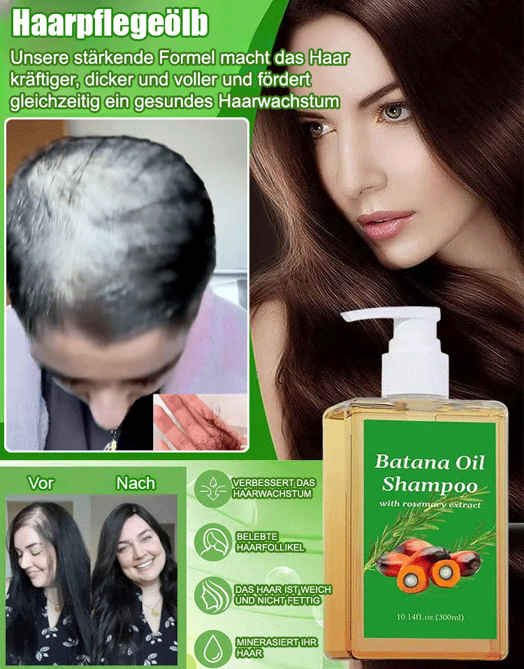 【✨50% Rabatt – Wahnsinnsangebot】🧴7-Tage-Haarwuchs-Shampoo, 3-in-1💫: Stoppt Haarausfall + Fördert Haarwachstum + Reguliert die Talgproduktion