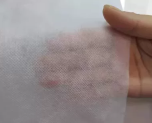 Nonwoven fabric