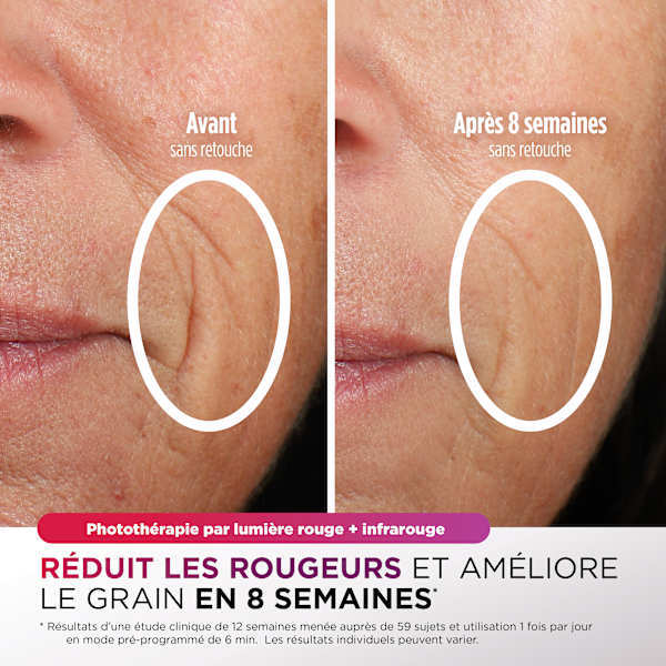 Masque LED Shark CryoGlow Lilas