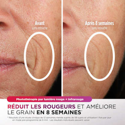 Masque LED Shark CryoGlow Lilas