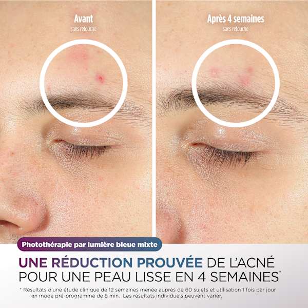 Masque LED Shark CryoGlow Lilas