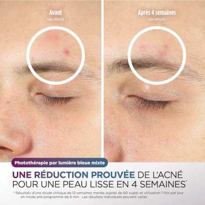 Masque LED Shark CryoGlow Lilas