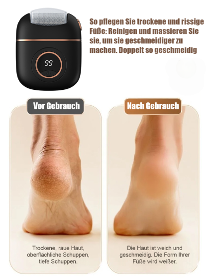 🛡️ Ultimativer elektrischer Hornhautentferner: Komfortable Fußpflege mit dreifacher Zufriedenheitsgarantie! 🦶🏻
