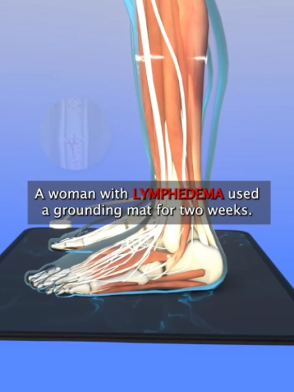 【Energie steigern】Mikrostrom Schmerz lindern Erdungsmatte