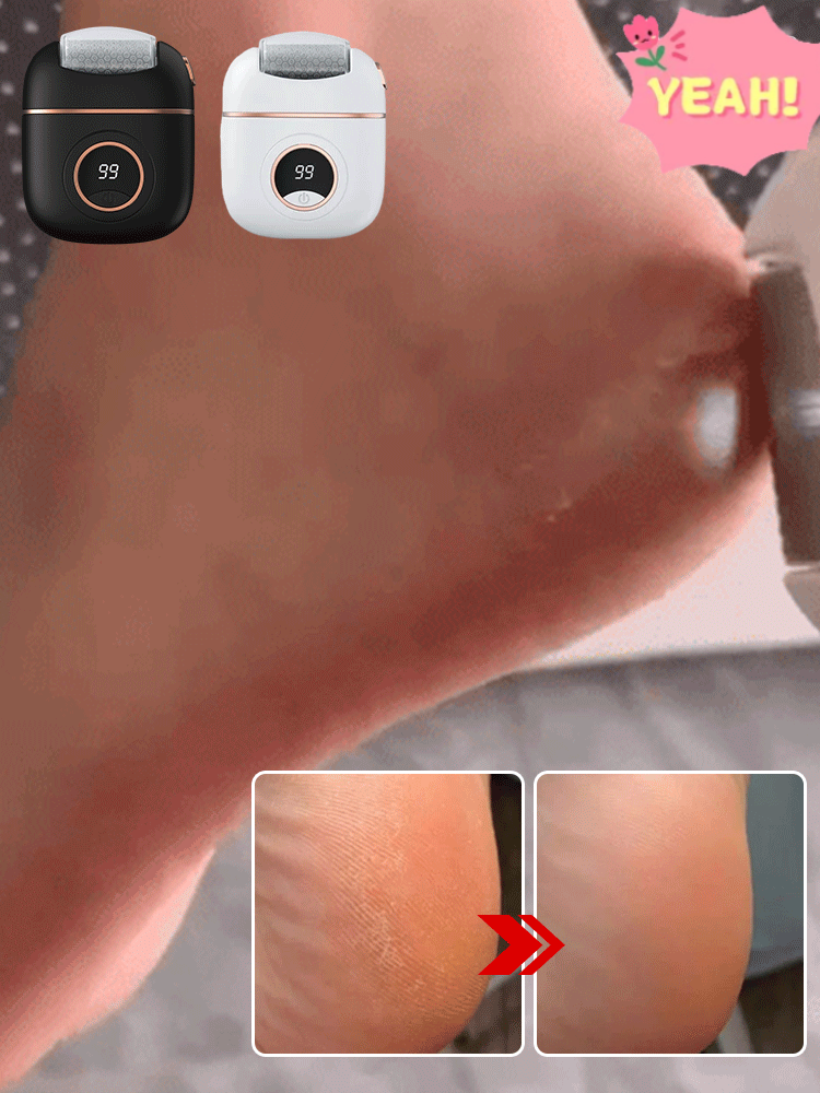 🛡️ Ultimativer elektrischer Hornhautentferner: Komfortable Fußpflege mit dreifacher Zufriedenheitsgarantie! 🦶🏻