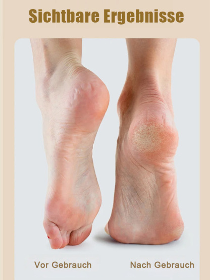 💎 Hochleistungs-Elektrofußfeile: 9000 U/min, sanfte Pflege, einfache Handhabung! 🌟