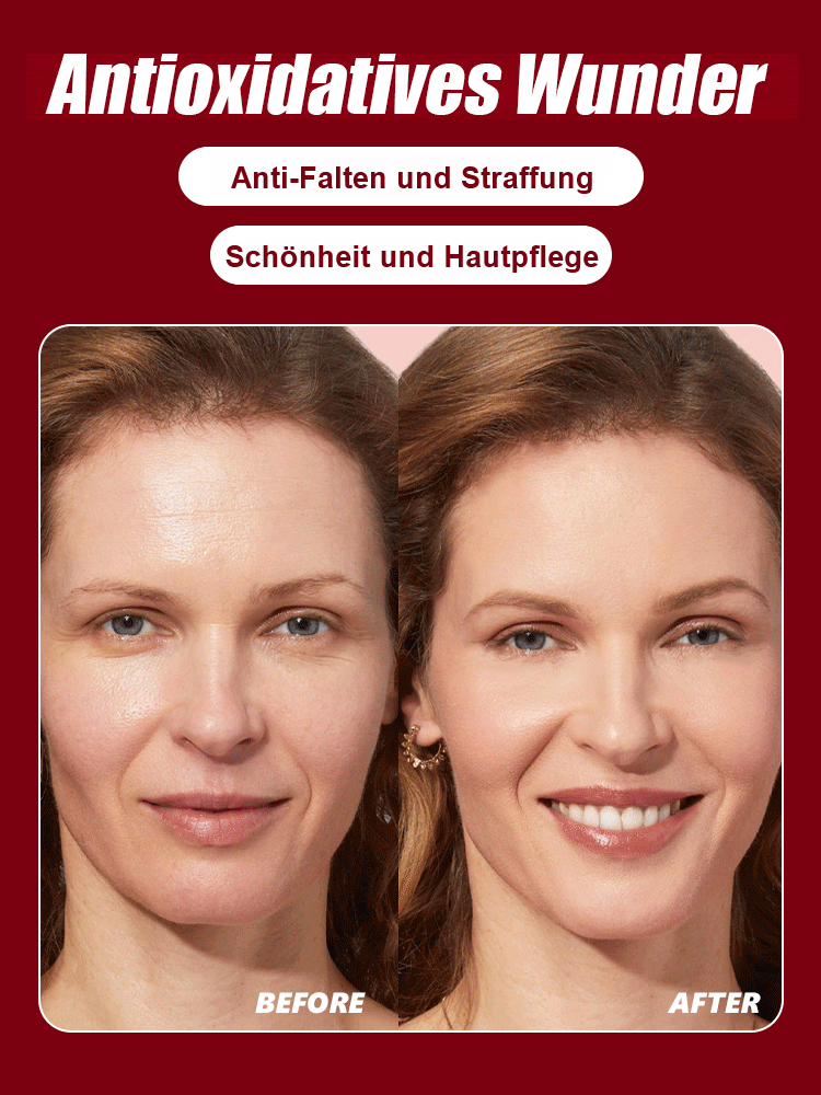 Mahaleb-Kirschbaumsetzling mit besonders großen Früchten