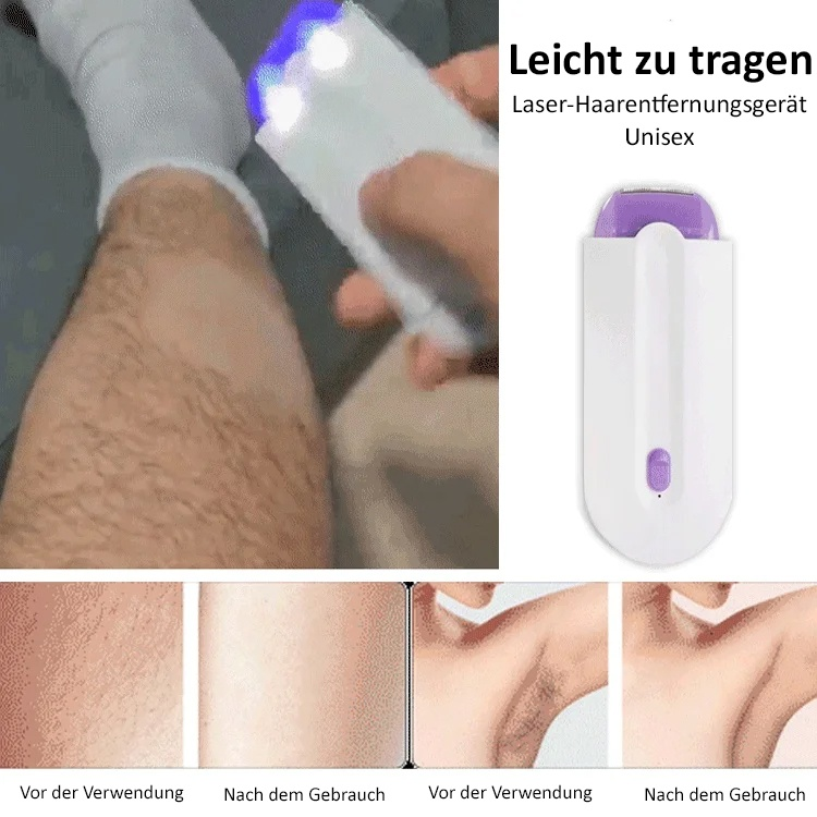 Intelligenter tragbarer Epilierer