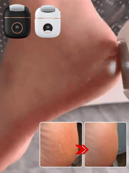 Neue digitale elektrische Fußpoliermaschine