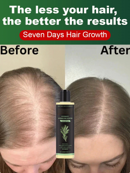 [Hair Growth and Intensification] Organic Rosemary Keratin Shampoo⭐The thinner your hair, the better it works—fuller in 2 weeks!